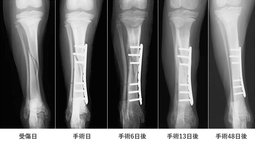 受傷日 手術日 手術6日後 手術13日後 手術48日後