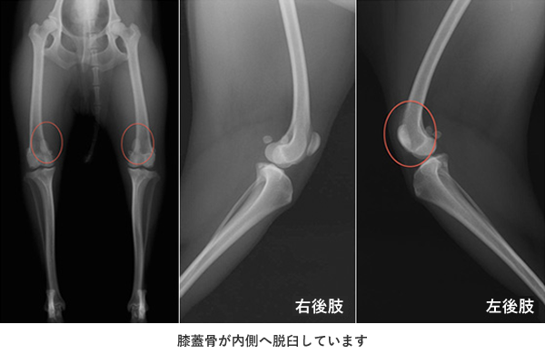 膝蓋骨が内側へ脱臼しています